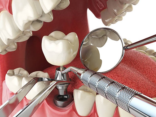 Best Emergency Treatment for Jaw Pain or Injury in Carrollton, OH